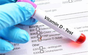25-羥基維生素D-磁微?；瘜W發(fā)光法（AE/AP） /熒光免疫層析解決方案（雙抗體夾心法）