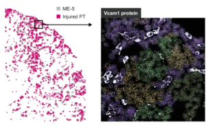 解密腎臟微環(huán)境對(duì)腎損傷有哪些影響