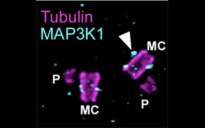 Cell子刊：2種中心體相關(guān)蛋白質(zhì)不為人知的新功能