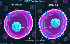 《自然醫(yī)學(xué)》：一種可以顯著延長乳腺癌患者生命的新藥