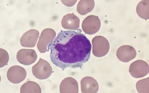 PNAS首次表明：人體組織中駐留在肺部的NK細(xì)胞在代謝方面與血液中循環(huán)的NK細(xì)胞不同