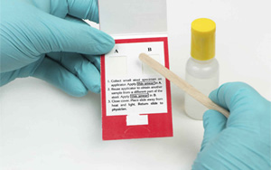 大便隱血（FOB）-免疫層析（膠體金、彩色乳膠及熒光免疫層析）解決方案