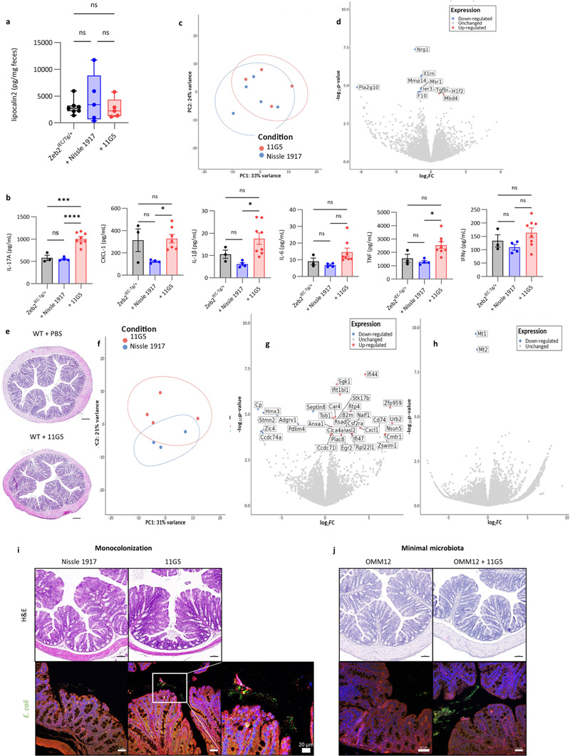
大腸桿菌11G5感染不會(huì)增加Zeb2 IEC-Tg/+小鼠的結(jié)腸炎癥，也不會(huì)影響WT同窩小鼠的上皮細(xì)胞