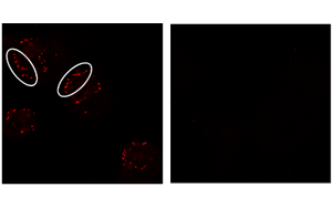 突變蛋白在一些致命癌癥中的新作用