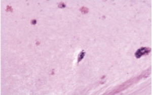 支原體清除試劑：解決細胞培養(yǎng)中支原體污染問題的利器