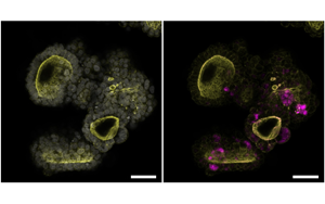 Cell：突破類器官研究限制！利用所有關(guān)鍵的胰腺細胞創(chuàng)造了一個新的類器官