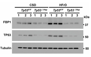 《Nature》脂肪肝為什么會(huì)導(dǎo)致肝癌？
