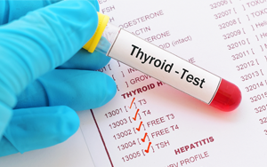  總及游離三碘甲狀腺原氨酸（TT3及FT3）-磁微?；瘜W(xué)發(fā)光法（AE/AP）/熒光免疫層析解決方案（雙抗體夾心法）
