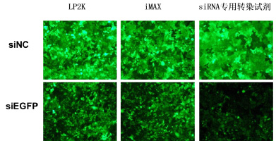 穩(wěn)定表達(dá)GFP的HeLa-EGFP細(xì)胞，沉默siEGFP，48h后熒光拍照