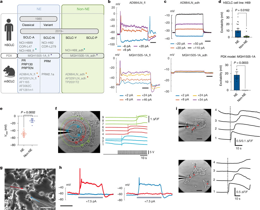 電激活的NE細胞產(chǎn)生自發(fā)和誘發(fā)的鈣波 電激活的NE細胞產(chǎn)生自發(fā)和誘發(fā)的鈣波