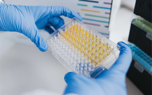 免疫技術(shù)新視界：層析、印跡、吸附與比濁的前沿碰撞