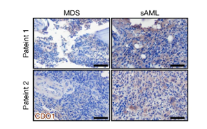 Nature：?；撬崮芡苿?dòng)白血病癌細(xì)胞生長(zhǎng)！