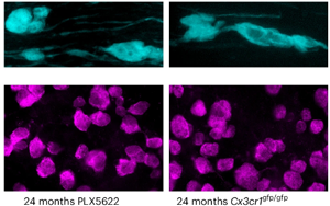 《Nature Neuroscience》大腦白質(zhì)為何隨年齡退化？因為免疫細胞“勾心斗角”