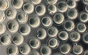 驅(qū)動重組蛋白、疫苗與CGT生產(chǎn)的無血清/低血清培養(yǎng)基