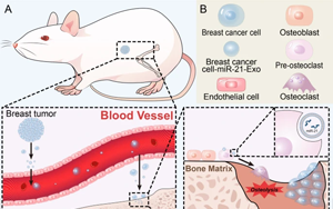 細(xì)胞外囊泡：乳腺癌宿主微環(huán)境中的