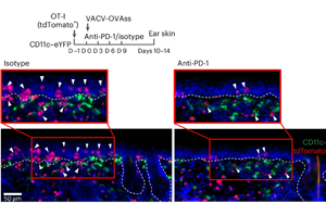 PD-1通過TGFβ信號(hào)通路調(diào)控皮膚組織駐留記憶T細(xì)胞（TRM）形成與功能分化的機(jī)制研究