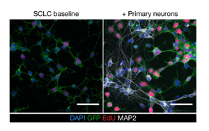 神經元活動依賴性機制驅動小細胞肺癌發(fā)病機制的新見解