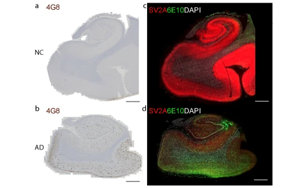 阿爾茨海默病中突觸囊泡蛋白2A在腦組織及胞外囊泡中的減少及其與Aβ、tau和APOEε4的關(guān)聯(lián)研究
