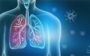 呼吸道感染病原體檢測高品質(zhì)原料推薦