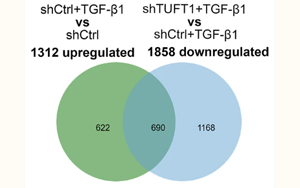 TUFT1通過穩(wěn)定TβRII蛋白促進肝星狀細胞活化為促轉(zhuǎn)移肌成纖維細胞的新機制及其在結直腸癌肝轉(zhuǎn)移中的作用