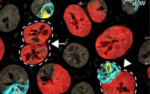 Nature 三連重磅！識破癌細胞的“詭計”，為結(jié)直腸癌患者帶來新希望