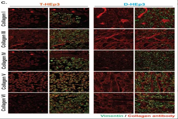 讓癌細胞“一睡不醒”！向腫瘤微環(huán)境中添加III型膠原蛋白可防止腫瘤復發(fā)和轉(zhuǎn)移