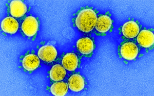 漏檢風(fēng)險將增加！奧密克戎新分支更隱匿