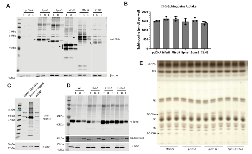 細胞運轉(zhuǎn)分析證實Spns1為LPC轉(zhuǎn)運體 細胞運轉(zhuǎn)分析證實Spns1為LPC轉(zhuǎn)運體
