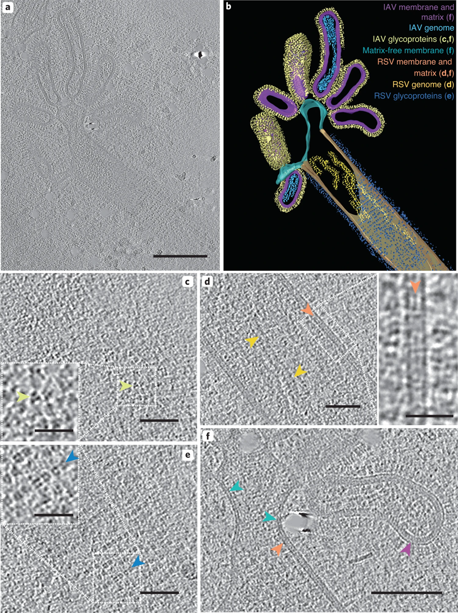 混合病毒顆粒包含IAV和RSV樣結(jié)構(gòu)區(qū)域 混合病毒顆粒包含IAV和RSV樣結(jié)構(gòu)區(qū)域