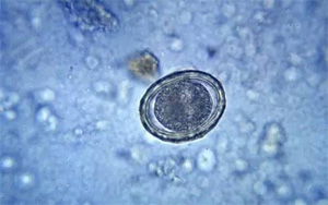 讓培養(yǎng)皿“患上”PTSD，然后為人類拓寬治療手段