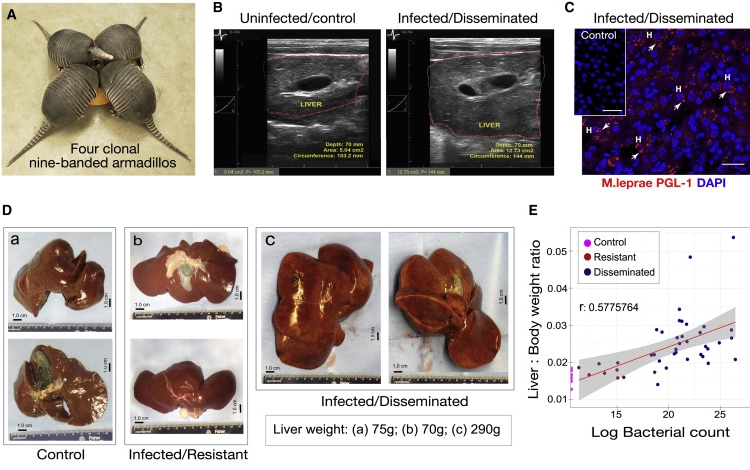 麻風(fēng)分枝桿菌促進(jìn)成年九帶犰狳體內(nèi)正常肝臟器官生長(zhǎng)而無(wú)肝損傷