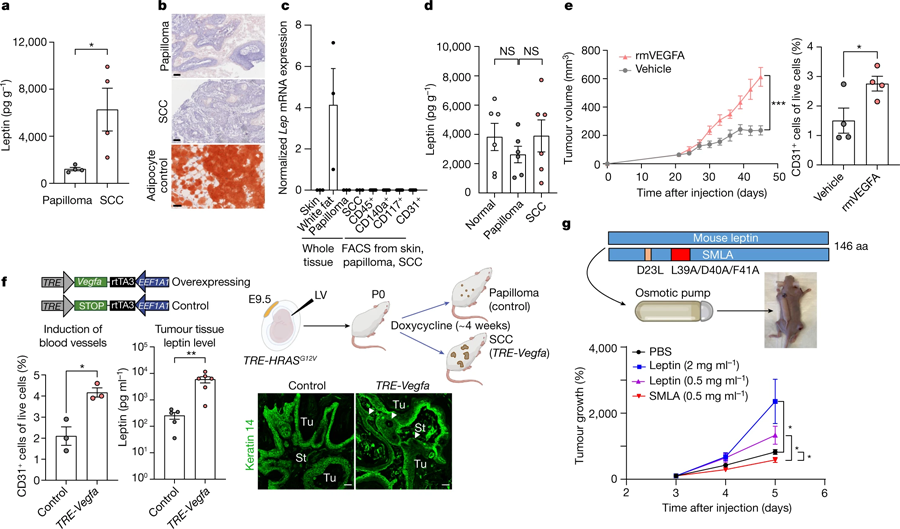 惡性腫瘤微環(huán)境中瘦素水平升高，是由血管生成增加引起的