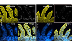 某些形式的兒童營養(yǎng)不良和發(fā)育遲緩可以通過疫苗預(yù)防