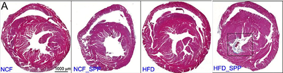 接種Spp病毒的高脂飲食小鼠心肌出現(xiàn)明顯的纖維化