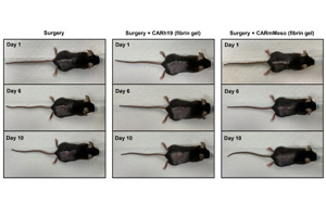 CAR-T細胞療法再獲突破！有效清除術后殘留癌細胞、預防腫瘤復發(fā)，即將開展臨床試驗