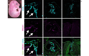 《Nature》淋巴系統(tǒng)潛在的新功能——造血！