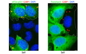 肺細胞如何保護自己免受RNA病毒感染？