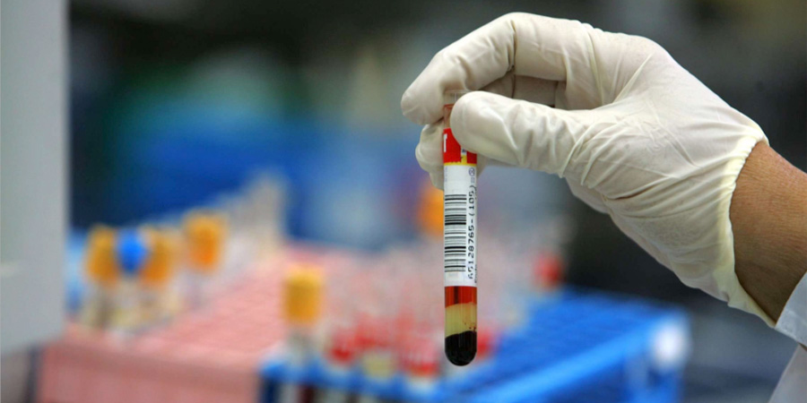 前蛋白檢測(cè)