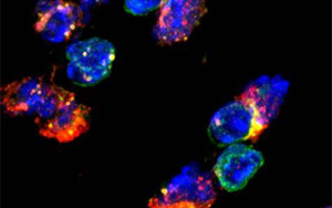 《Nature Immunology》兩種不同類(lèi)型的免疫細(xì)胞幫助20億人控制結(jié)核病