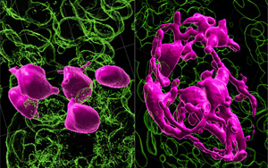 黑發(fā)原來是這樣變白的！Nature最新研究發(fā)現(xiàn)逆轉(zhuǎn)白發(fā)的關(guān)鍵所在