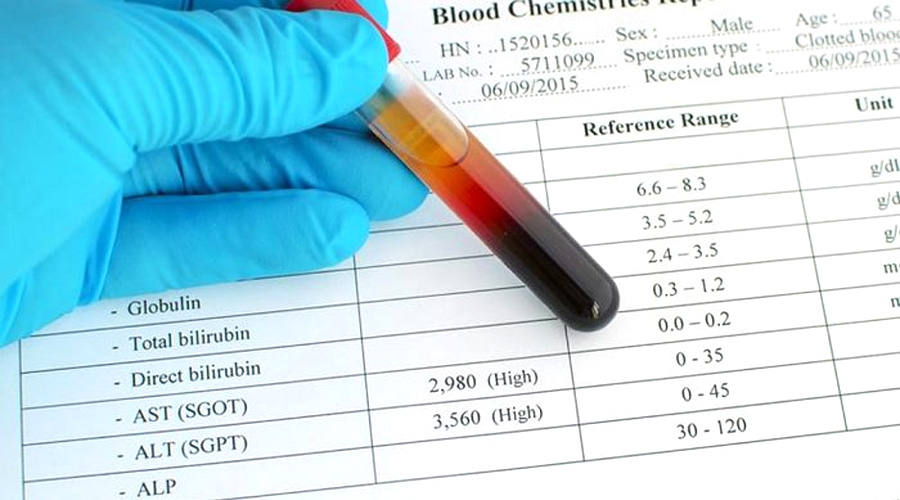 谷丙轉(zhuǎn)氨酶（ALT）檢測