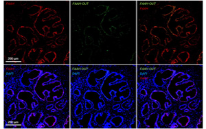 一種罕見(jiàn)基因突變，感覺(jué)不到疼痛！新研究揭示其獨(dú)特的分子機(jī)制