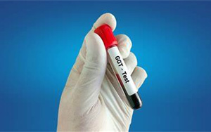 γ-谷氨酰轉(zhuǎn)移酶（γ-GT）檢測試劑盒用原輔料