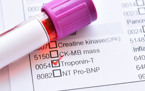 心肌肌鈣蛋白T（cTnT）-磁微?；瘜W(xué)發(fā)光法（吖啶酯） /熒光免疫層析解決方案