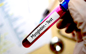 肌紅蛋白（Myo）-磁微?；瘜W(xué)發(fā)光（AE/AP） /熒光免疫層析解決方案