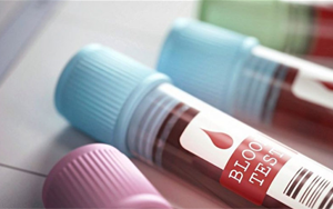 脂聯素 糖尿病早期篩查的“新指標”