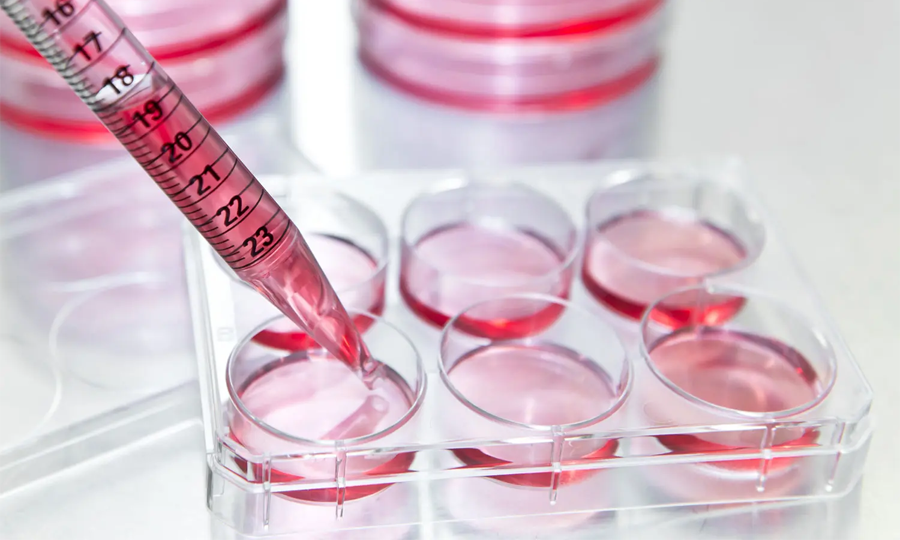 細(xì)胞培養(yǎng) 細(xì)胞培養(yǎng)