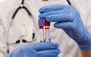 肌酸激酶同工酶（CK-MB）-磁微粒化學法學發(fā)光（AE/AP） /熒光免疫層析解決方案