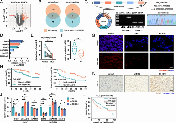 微陣列分析發(fā)現(xiàn)circASH2在HCC中具有轉(zhuǎn)移抑制作用，并受DHX9調(diào)節(jié)