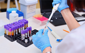 可溶性生長刺激表達基因2蛋白（ST2）- 磁微?；瘜W(xué)發(fā)光法（吖啶酯）/熒光免疫層析解決方案